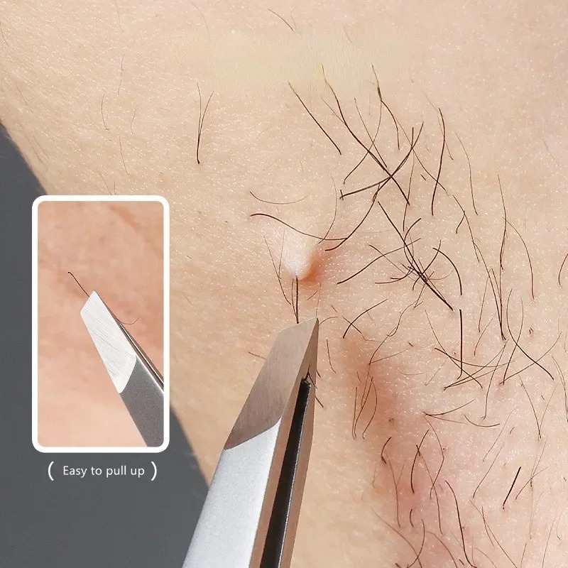 Paslanmaz Çelik Eğik Kaş Klips - Eyelash Extension For No Eyelid incelemesi ve fiyatı